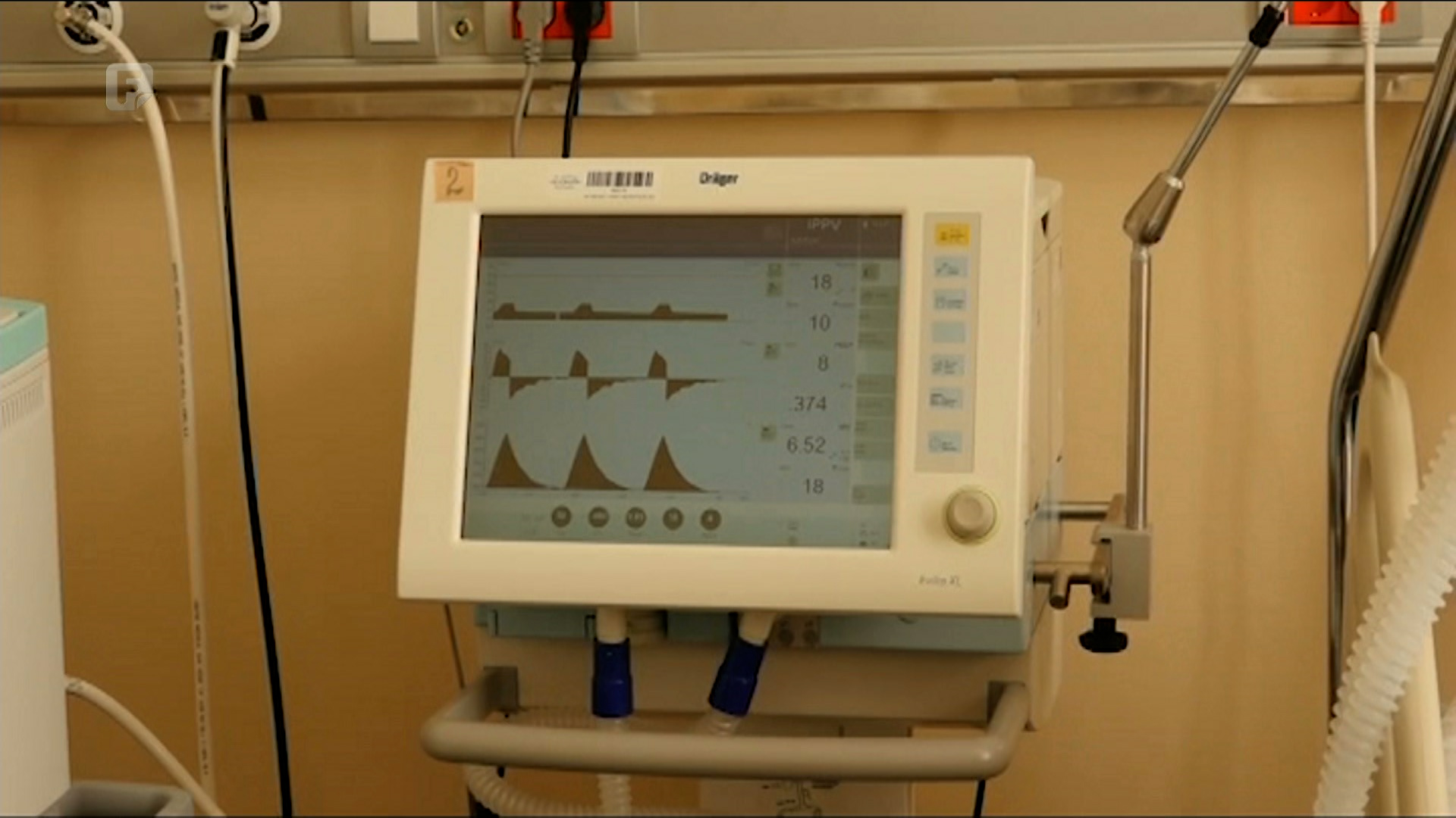 U bijeljinskoj covid bolnici najveći je broj do sada hospitalizovanih